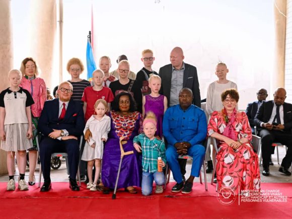 Journée internationale de sensibilisation à l’albinisme : Irène Esambo affirme des avancées dans le domaine de l’inclusion sociale