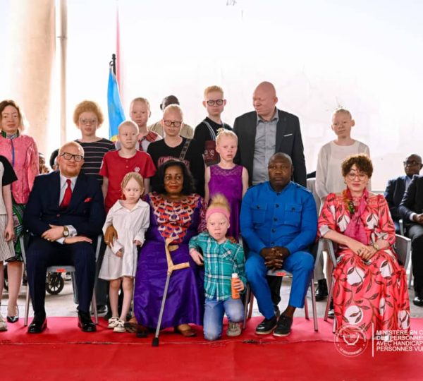 Journée internationale de sensibilisation à l’albinisme : Irène Esambo affirme des avancées dans le domaine de l’inclusion sociale