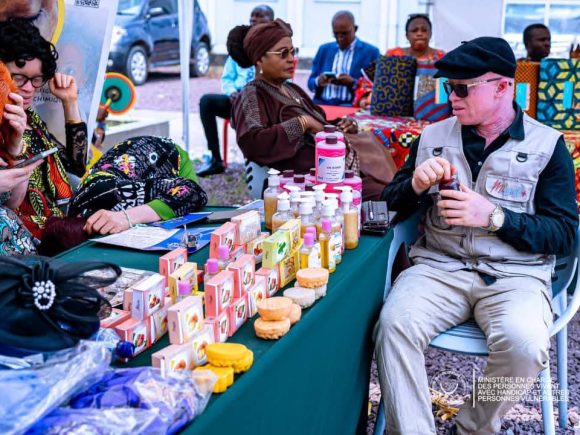 Programme présidentiel “Debout jeunes congolais” pour l’emploi et l’entrepreneuriat: les jeunes avec handicap et les personnes atteintes d’albinisme au troisième axe